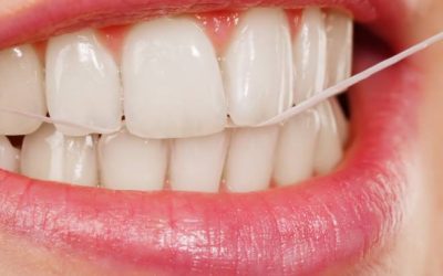 Teeth Whitening In Campbelltown: Benefits